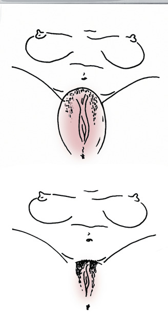 Pompa Vaginala Seven Creations »Clit Pump« Roz, poza 1