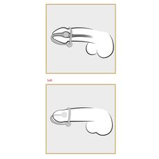 Inel Penis Push "Sperm Stopper" Galben##
