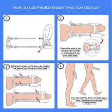 Aparat marirea penisului Androextender "Pro Extender"##