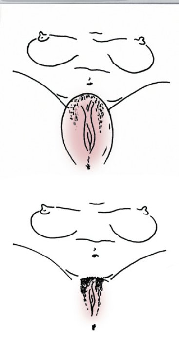 Pompa Vaginala Seven Creations »Clit Pump« Roz
