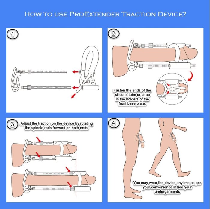 Aparat marirea penisului Androextender "Pro Extender"##